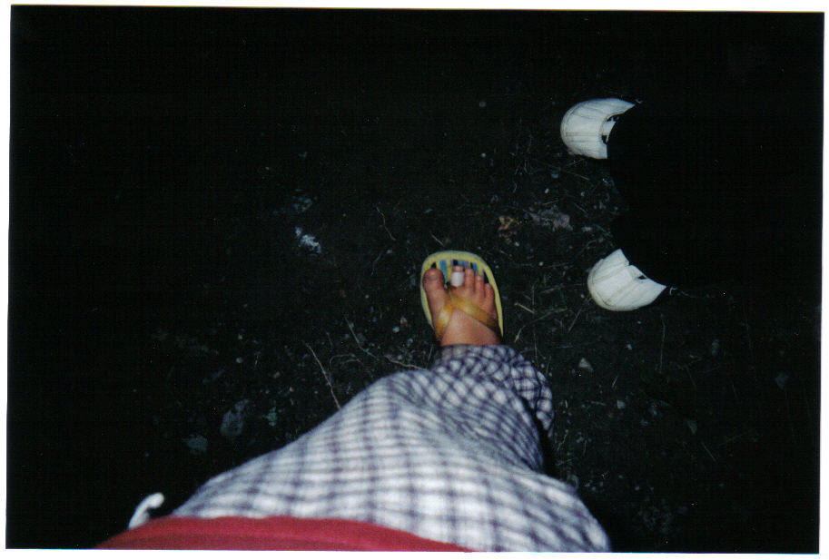mytoe.jpg